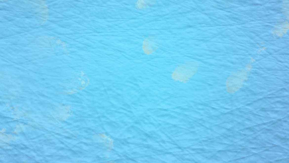"Abklatschtest" con LAMILUX Antibac "Abklatschtest" con LAMILUX Antibac